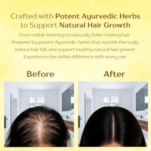 Image of BRAHM HERBAL Ayurvedic Hair Oil for Hair Growth | Stimulates Hair Growth, Controls Hair Fall & Dandruff | Herbal Mix Hair Oil for Men & Women | Powered By 15 Ayurvedic Herbs - Bhringraj, Jatamansi, Ratanjot, Amla & More | No Added Chemical & Mineral Oil | (100 ML)