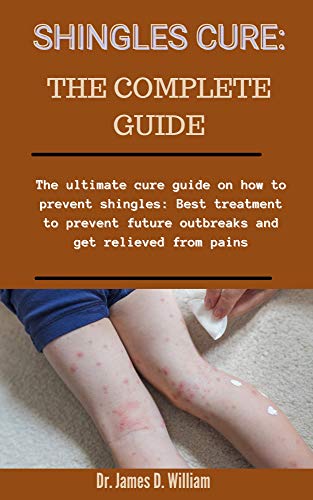 Shingles Cure: The Complete Guide: The Ultimate Cure Guide On How To Prevent Shingles, Best Treatment To Prevent Future Outbreaks And Get Relieved From Pains