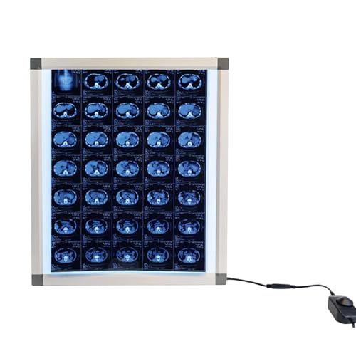 GNbow Professionelle Röntgenfilm-Leuchtbox, Led-röntgen-sichtbox, Röntgenfilmbetrachter mit Halterung, Röntgen-Betrachter mit Einstellbarer Helligkeit (41 * 47CM)