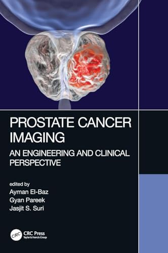 Prostate Cancer Imaging: An Engineering and Clinical Perspective