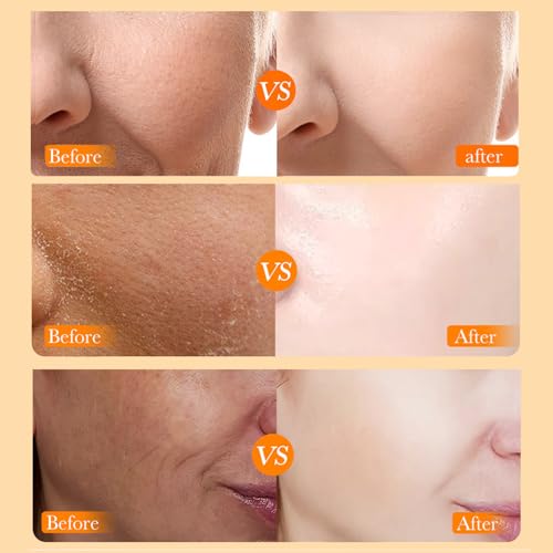 INSEEK Vitamin C Travel Size Skincare Set, Antioxidant Skin Care Gift Set for Women Girl, Smooth Wrinkles & Fine Lines, and Improving Dull Skin, Deep Moisturizing
