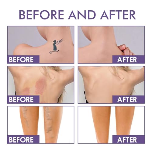 Körper Concealer Cream, Tattoo Abdeckung Creme,Abdeckcreme Für Besenreiser, Abdeckcreme Für Besenreiser, Narben Concealer Wasserfest, Langanhaltend Körper Make Up Body concealer