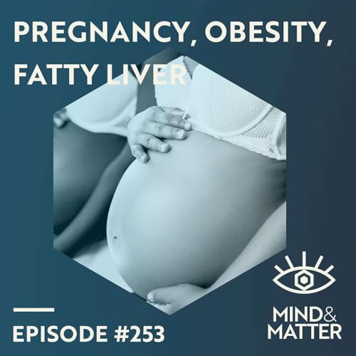 Page de couverture de Maternal Obesity, Immune System, Fatty Liver Disease & Epigenetics | Elvira Mass | 253