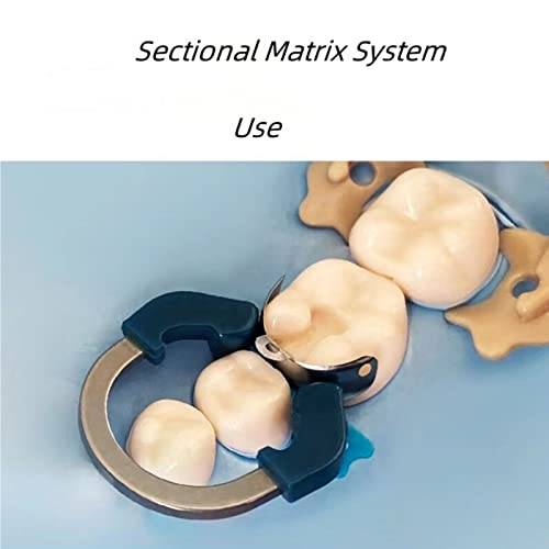 Image of Dental Sectional Matrix Ring Clamp Spring Clip, Autoclavable Nickel Titanium Orthodontic Clamp Rings, Contoured Matrices System for Pre and Post Molars. (R6 Blue+Green)