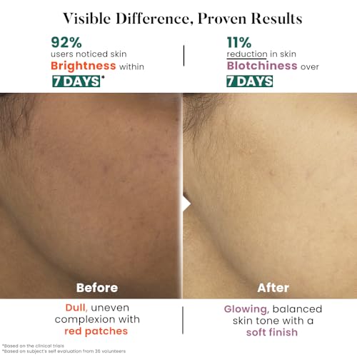 Image of Bio Code 1.5% Alpha Arbutin Brightening Moisturizer (100ml) - with 1% Tranexamic Acid, 1% Licorice & 2% Niacinamide | For Even Tone & Deep Hydration | AI-Enhanced Formula | Dermatologist Recommended