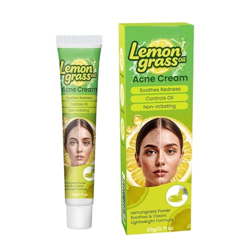 Removedor de espinillas, fórmula hidratante y calmante, 20 g, crema Acnẹ, loción facial calmante e hidratante, textura no grasa, ideal para la rutina diaria, cuidado de la piel por la mañana y por la