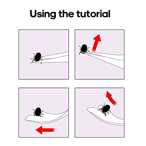 2 pezzi Pinza per Zecche Pinzetta per Zecche