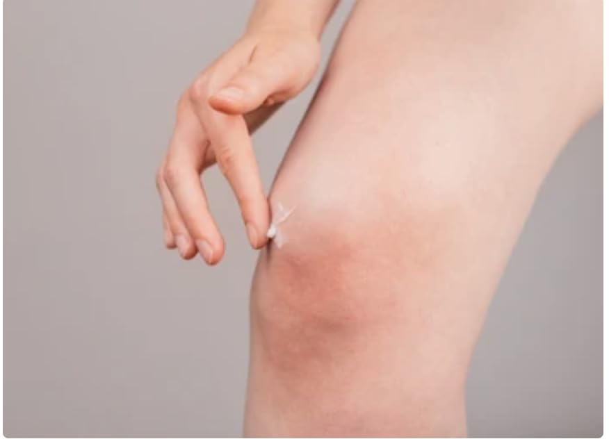 Productos Para Ganar Masa En Poco Tiempo., Imagen adicional