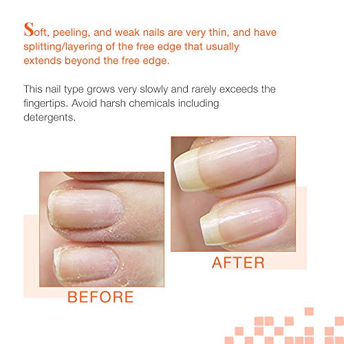 Nail Tek Intensive Therapy 2, Nail Strengthener For Soft And Peeling Nails, 0.5 Oz Value 4-Pack #TOP2