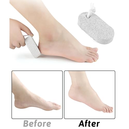 zoerbufan Pumice Stone for Feet/Hands/Body, Natural Lava Pumice Stone for Dead Hard Skin Removal, Foot Scrubber, White Calluse Remover, Foot File for Men/Women for Exfoliation(Oval) - Image 3