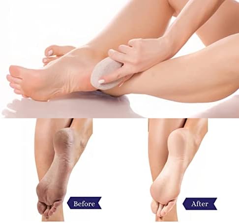 Naturacare Pumice Stone 2Pcs, Natural Lava Foot Scrubber Pumice Stone for feet/Hands/Body, Natural Foot File Men/Women and Hard Skin Callus Remover for Skin Exfoliation