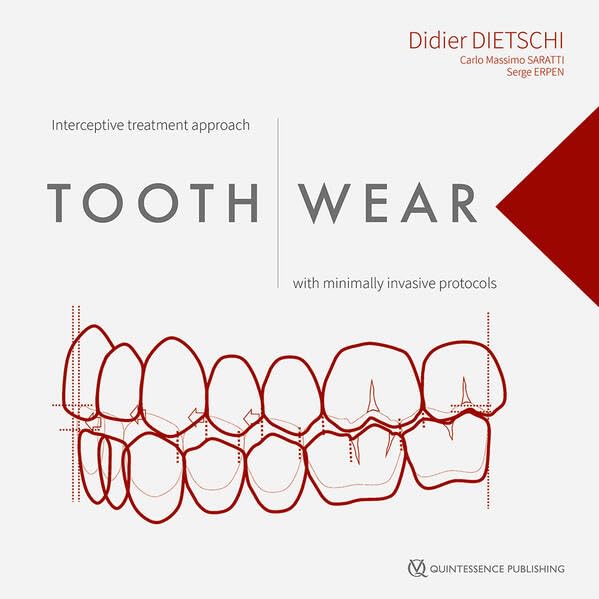 Cover for Tooth Wear: Interceptive Treatment Approach With Minimally Invasive Protocols