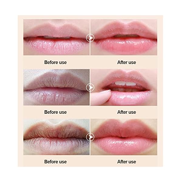 Lip-Masks-Collagen-Lip-Mask-20-Pcs-Lip-Mask-for-Dry-Lips-Lip-Masks-Skincare-Crystal-Lip-Pads-for-Moisturizing-Anti-Wrinkle-Anti-Aging-Firms-Hydrates-Lips-Red VEZE Lip Masks, Collagen Lip Mask 20 Pcs, Lip Mask for Dry Lips, Lip Masks Skincare, Crystal Lip Pads for Moisturizing, Anti-Wrinkle, Anti-Aging, Firms and Hydrates Lips Red