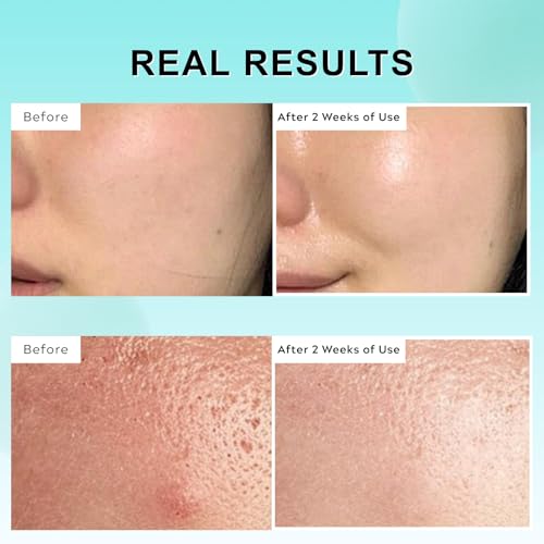 PDRN 100 Essence, PDRN Serum Korean, Intensive Glow Serum for Face Glass Skin, Smooth Fine Lines, Boost Elasticity, Skin Restoration & Plumping, Hydrating & Moisturizing, 30ml - Image 6