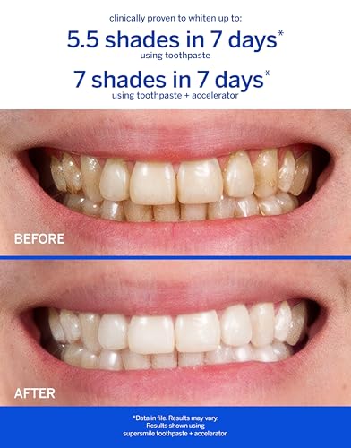Image of Supersmile Original Mint Whitening Toothpaste, Fluoride-Free, 3.4 Oz | Calprox Powered, Whitens 5.5 Shades in 7 Days, TSA-Approved Travel Size, Signature Wild Mint, Veneer Safe