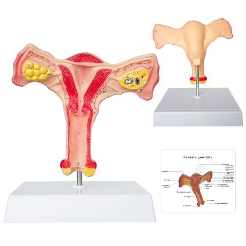 SFXYJ Human Female Uterus Ovary Anatomy Model, Life Size Reproductive Organ shows Vagina Bilateral Ovarian with Product Manual Card and Base, PVC for School Teaching Demonstration and Research