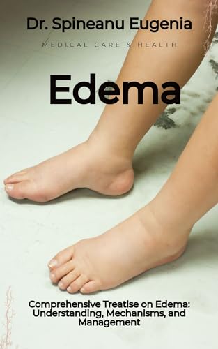 Comprehensive Treatise on Edema: Understanding, Mechanisms, and Management