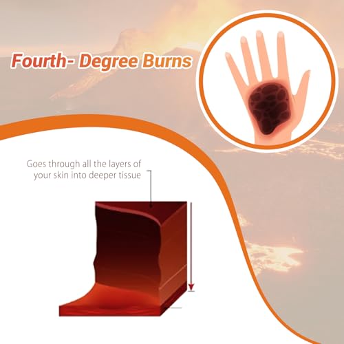 Image of Burn Wound Packing Trainer, Burn Moulage, Adhesive Skin Burn Wound Trainer for Wound Care Training, Fourth Degree Burn Wound Training Model
