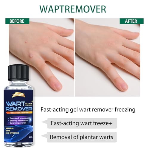 Strongest Wart Corn Remover Mask for Toes Fingers: Foot Wart Corn Removal for Feet Hands - Exclusive Formula Salicylic Acid Wart Off Mask for Plantar Wart, Flat Wart for You - 1 Oz 2 PCS