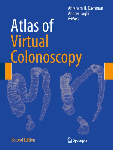 Atlas of Virtual Colonoscopy
