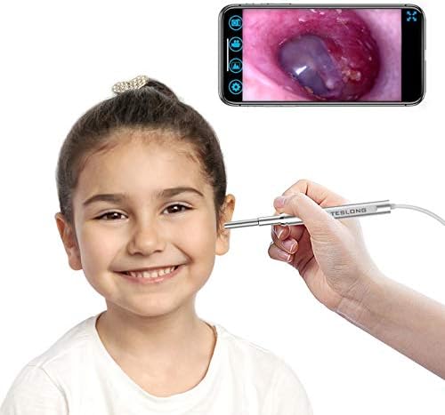 WiFi Otoscope for iPhone, Teslong Ultra-Slim Wireless Ear Scope Camera with Replaceable Otoscope Specula, Waterproof Washable, Check Swimmer’s Ear