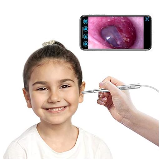 WiFi Otoscope for iPhone, Teslong Ultra-Slim Wireless Ear Scope Camera with Replaceable Otoscope Specula, Waterproof Washable, Check Swimmer’s Ear