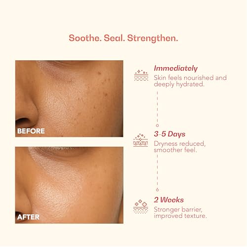 Image of Ceramide Moisturizer for Dry & Damaged Skin, with Postbiotics | Daily Skin Barrier Repair Cream | Deep Hydration Face Cream | Normal, Dry, Sensitive Type | 50g