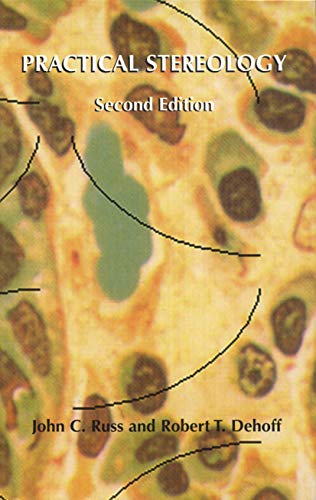 Practical Stereology view 2