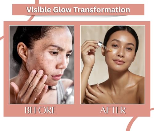 Image of Earth N Pure Kumkumadi Tailam Face Oil Enriched with Saffron and 24 Powerful Herbs, Natural & Therapeutic Grade 250 ml