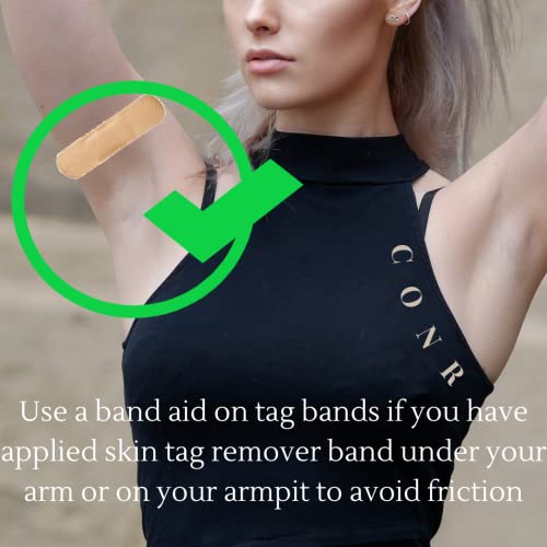 Image of Skin Tag Remover Kit (2-4mm) CONR Micro Painless DIY at Home with Cleansing Swabs Non Toxic Face Care Mole Wart Tool For Small To Medium Skin Tag (not for smaller than 2mm or flat skin tags)