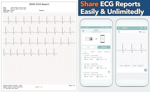 emay portable ecg monitor  record ecg and heart rate  compatible with smartphone and pc