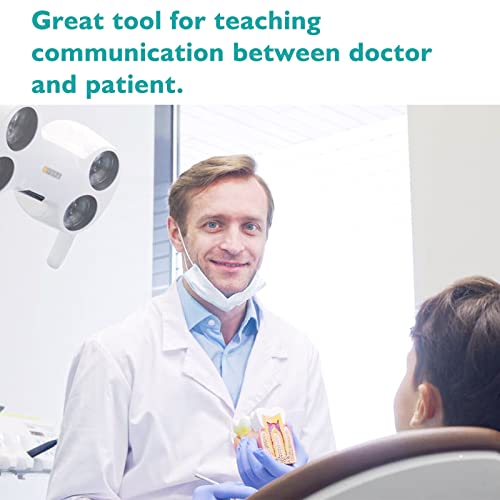 Lvchen Dental Caries Teeth Model - Anatomy Education Model Caries Bilateral Comparison Study Model 6 Times Cross-Section Demonstration Model Tooth Decay Props For Science Teaching #TOP5