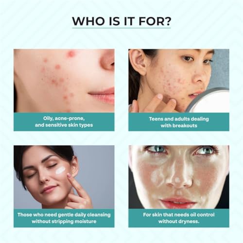 Image of Dr. Sakhiya's Acne & Pimple Face Wash (100ml) for Oily & Acne-Prone Skin | 2% Salicylic Acid Niacinamide | Controls Oil, Reduces Breakouts & Blackheads | Dermatologist Formulated