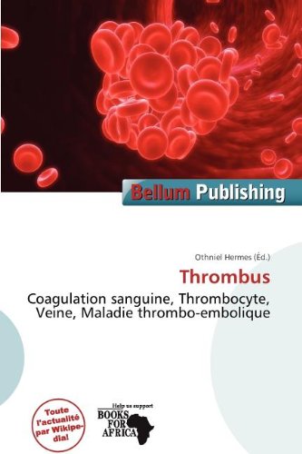 Thrombus: Coagulation sanguine, Thrombocyte, Veine, Maladie thrombo-embolique