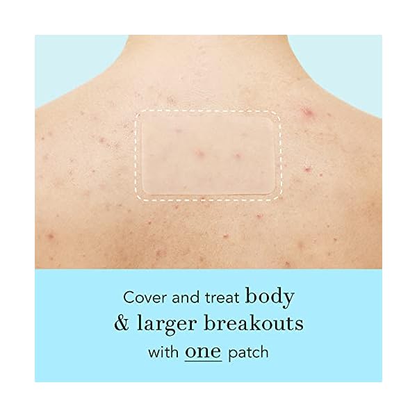 Rael Pimple Patches, Miracle XL Spot Control Cover - Hydrocolloid Acne Patch for Face, Zits & Blemish, Back and Body, Korean Skin Care, Vegan, Cruelty Free (6 Count)