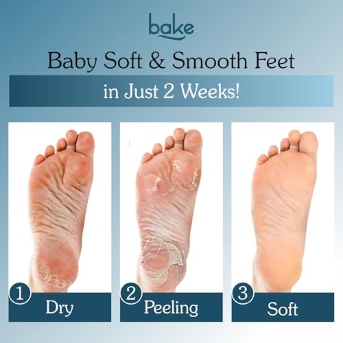 Image of BAKE AHA + BHA Foot Peeling Mask | Reduces Dry Skin & Hard Calluses| Exfoliates,Moisturizes & Hydrates Feet | Nourishing Foot Mask | Fits Like Socks | For Men & Women