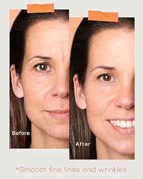 Cordless Red Light Therapy Mask for Face, 630nm Red Light for Anti-aging &465nm Blue Light for Acne, 36 LEDs and 258 Silicone Dots for Even Coverage,Lightweight,3 Modes for Daily Skincare,Storage Bag