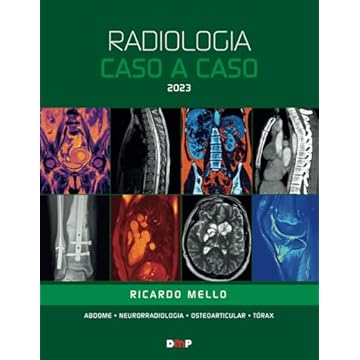 Capa do livro Radiologia Caso a Caso 2023 (Portuguese Edition)