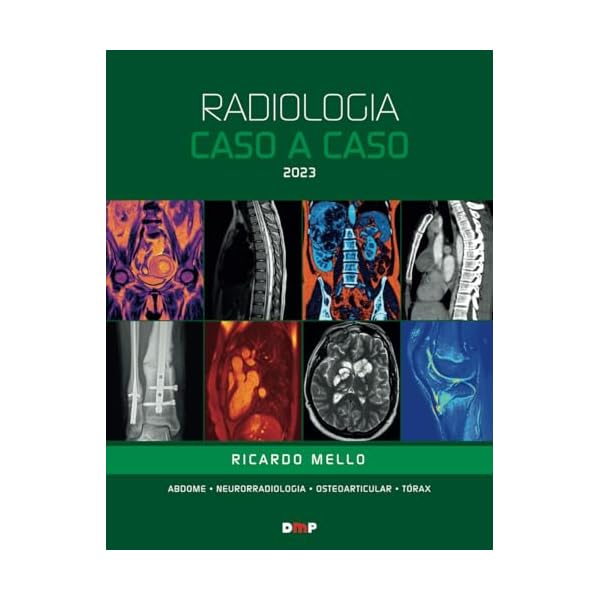 Capa do livro Radiologia Caso a Caso 2023 (Portuguese Edition)