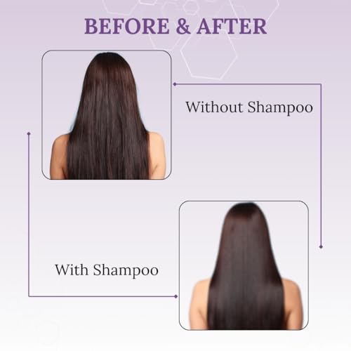 Image of Hard Water Everyday Hair Growth Shampoo | Dermatologically Tested Anti-Hair Fall Shampoo with Procapil | Strengthens Weak Roots and Reduces Breakage (200 ml, Unisex)