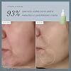 Alpha-H Serum - Daily Brightening For Dull, Uneven Complexion - Helps Boost Glow And Smooth Texture - Lightweight Comfort For Dry, Sensitive Skin