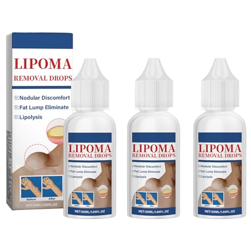 TQIUH Herbal Lipoma Removal Drops Lipoma Removal Lipoma Removal Cream Creating Perfect Skin(3PCS)