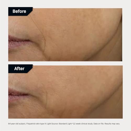 Revision Skincare D·E·J Face Cream®, Advanced Anti Aging Moisturizer, Lifting and Firming, Antioxidant Rich