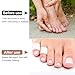 Alpinleux 10 Pack Silicone Toe Sleeves, Toe Protectors for Pinky Toes, Toe Covers for Pain Relief, Cracking, Rubbing, Ingrown Toenails, Missing Toenails, Bunion Blisters, Hammer Toes (White)