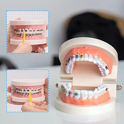 Obtanim 100 Pcs Colorful Disposable Plastic Braces Elastic Rubber Bands Placers Tool For Braces Dental Orthodontic #TOP4