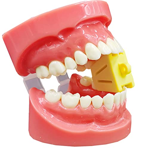 Gxxmei DBB-12 12Pcs Dental Oral Silicone Mouth Prop Bite Blocks Latex Free Cheek Retractor thumb #3