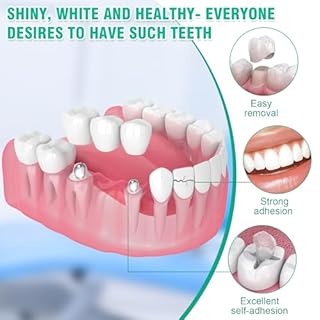 Cemento Dentale Definitivo, Kit Riparazione Denti, Cemento Dentale Fissa Ponti, Capsule Dentali e Denti a Perno