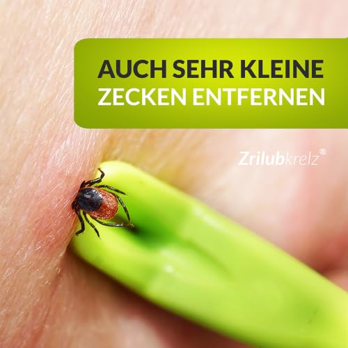 Zrilubkrelz® Zeckenhaken Zeckenzange - 3er Set - Für Hunde, Katzen etc.