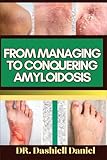 FROM MANAGING TO CONQUERING AMYLOIDOSIS: Expert Guide To Understanding Amyloidosis Causes, Symptoms, Preventing, Treatment For Optimal Wellness