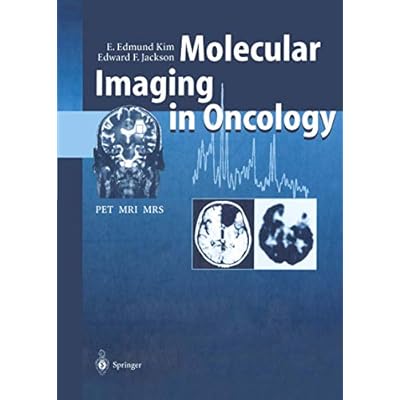 Molecular Imaging in Oncology